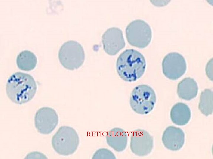 RETICULOCYTES 