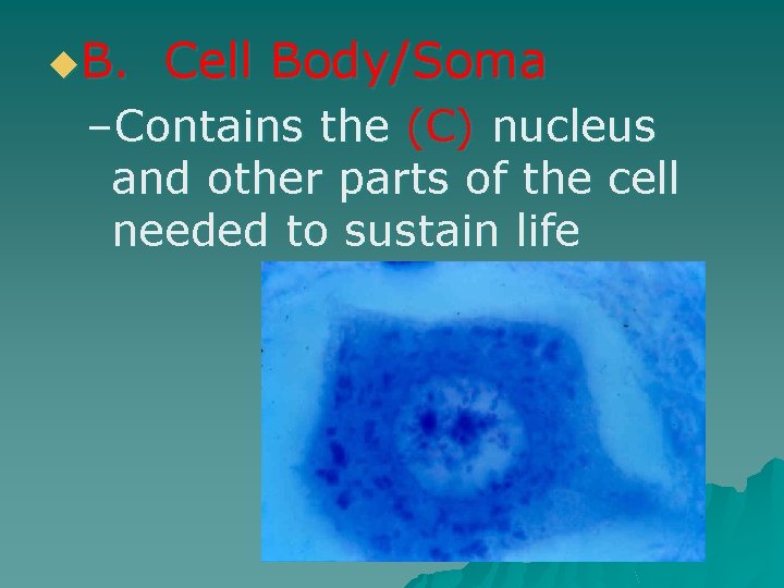 u. B. Cell Body/Soma –Contains the (C) nucleus and other parts of the cell