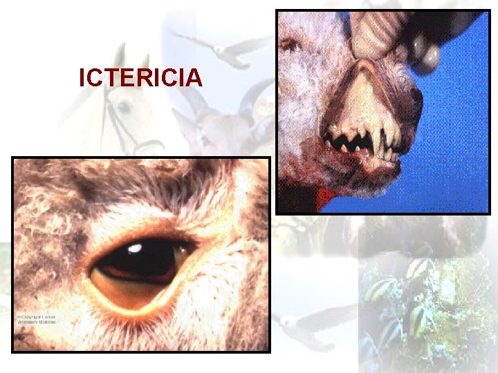 ICTERICIA 