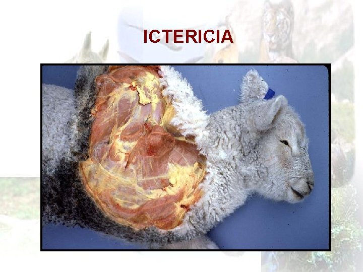 ICTERICIA 