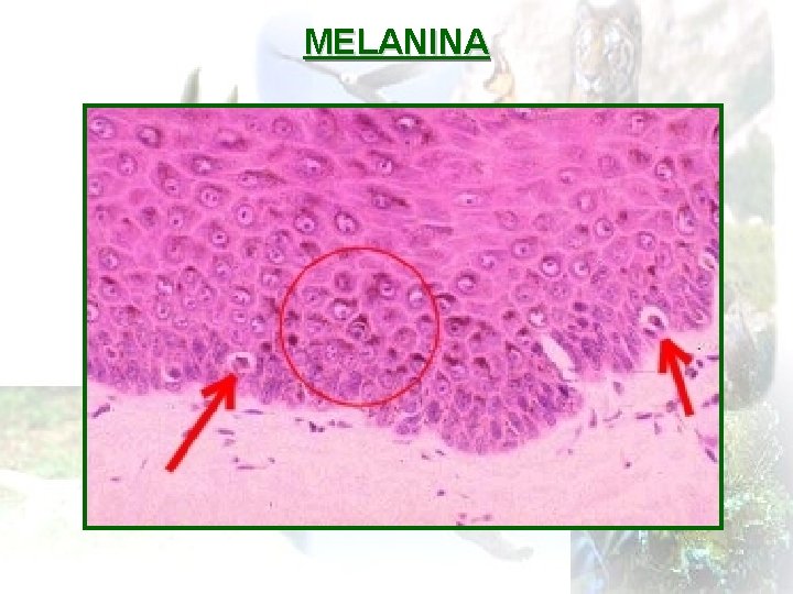 MELANINA 