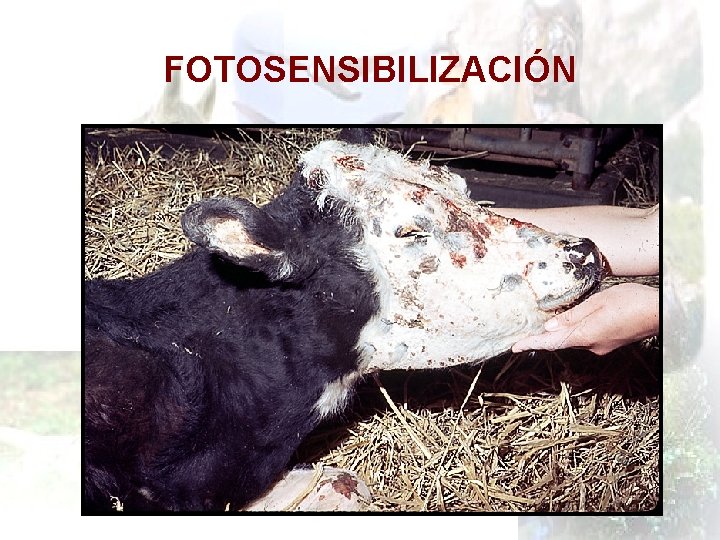 FOTOSENSIBILIZACIÓN 
