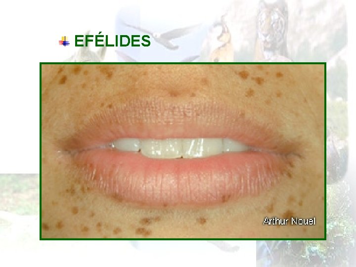 EFÉLIDES 