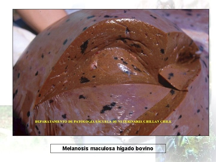 Melanosis maculosa hígado bovino 