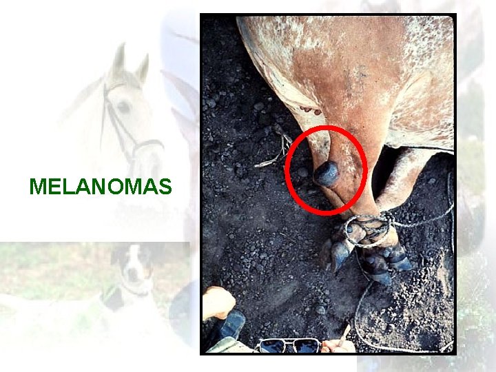 MELANOMAS 