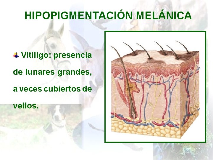 HIPOPIGMENTACIÓN MELÁNICA Vitíligo: presencia de lunares grandes, a veces cubiertos de vellos. 