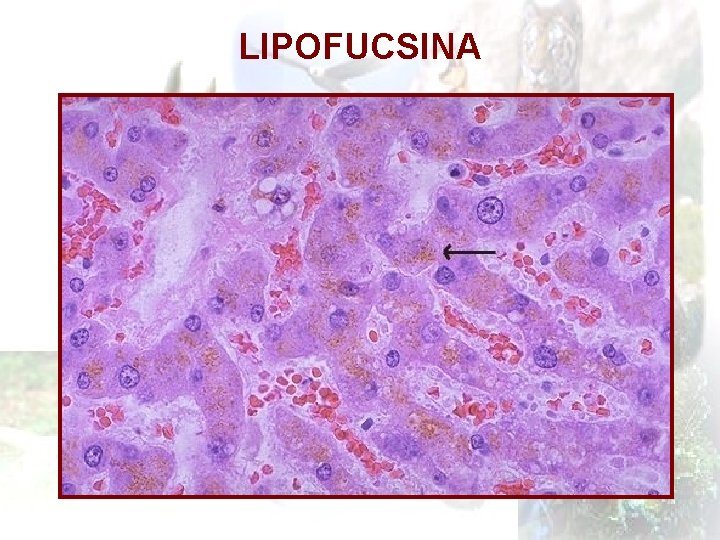 LIPOFUCSINA 
