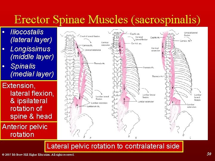 Erector Spinae Muscles (sacrospinalis) • Iliocostalis (lateral layer) • Longissimus (middle layer) • Spinalis