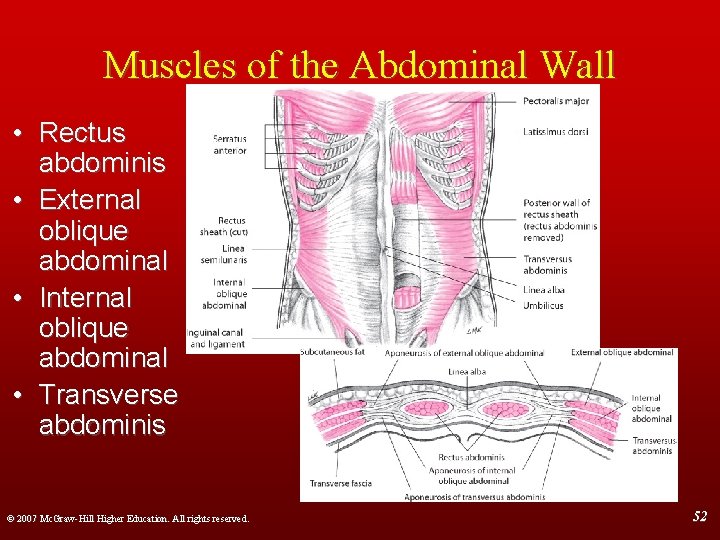 Muscles of the Abdominal Wall • Rectus abdominis • External oblique abdominal • Internal