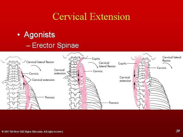 Cervical Extension • Agonists – Erector Spinae © 2007 Mc. Graw-Hill Higher Education. All