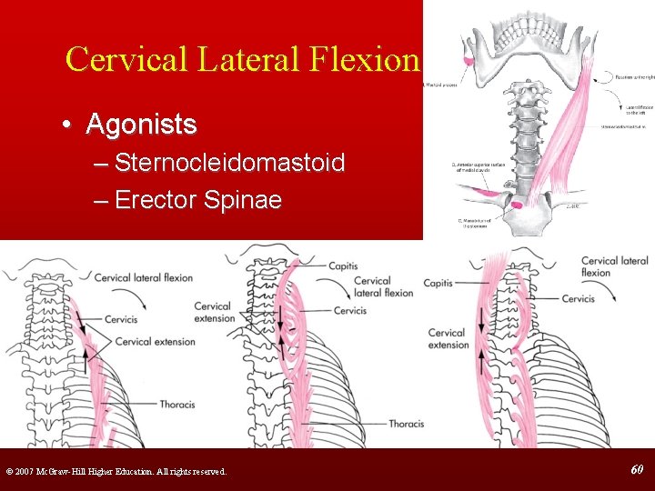 Cervical Lateral Flexion • Agonists – Sternocleidomastoid – Erector Spinae © 2007 Mc. Graw-Hill