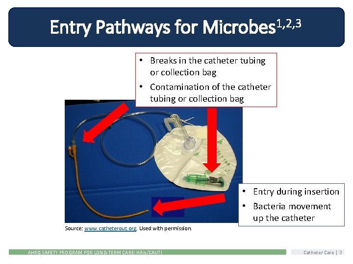Entry Pathways for Microbes 1, 2, 3 • Breaks in the catheter tubing or