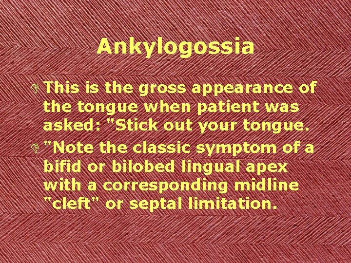 Ankylogossia D This is the gross appearance of the tongue when patient was asked: