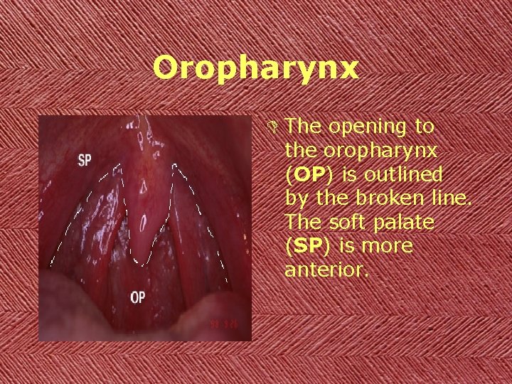 Oropharynx D The opening to the oropharynx (OP) is outlined by the broken line.