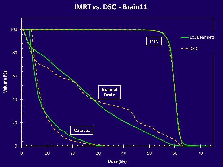 PTV Normal Brain Chiasm 