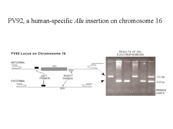 PV 92, a human-specific Alu insertion on chromosome 16 