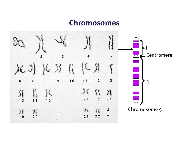Chromosomes p Centromere q Chromosome 5 