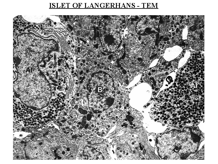 ISLET OF LANGERHANS - TEM 