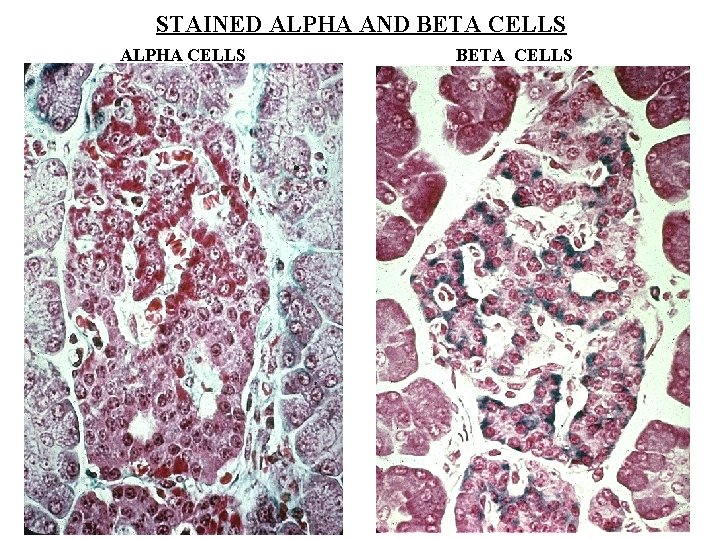 STAINED ALPHA AND BETA CELLS ALPHA CELLS BETA CELLS 