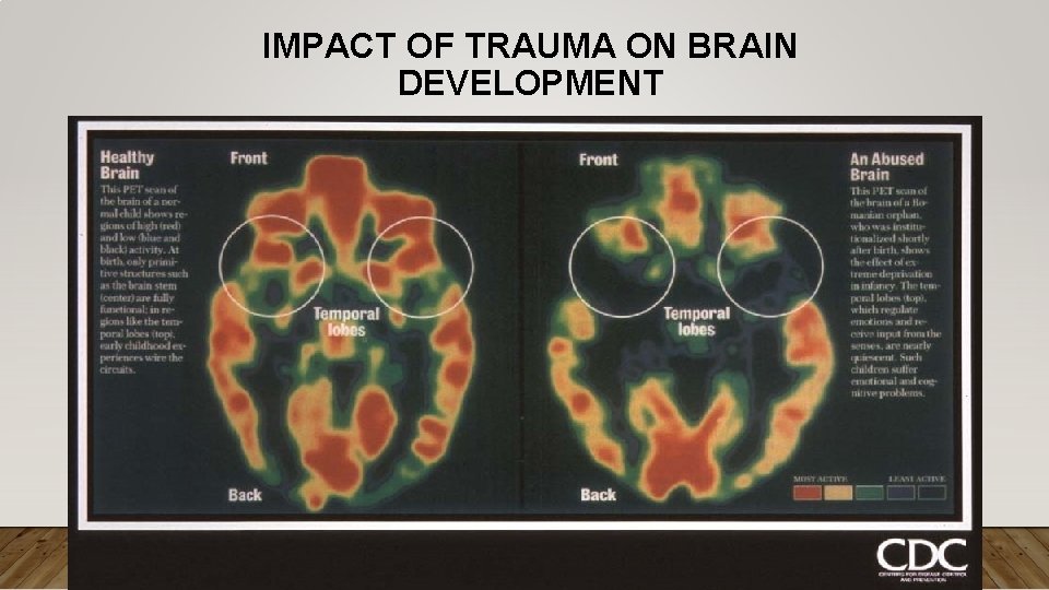 IMPACT OF TRAUMA ON BRAIN DEVELOPMENT 