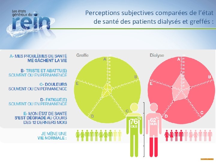 Perceptions subjectives comparées de l’état de santé des patients dialysés et greffés : Perceptions subjectives comparées de l’état de santé des patients dialysés et greffés :