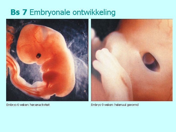 Bs 7 Embryonale ontwikkeling Embryo 6 weken: hersenactiviteit Embryo 9 weken: helemaal gevormd 