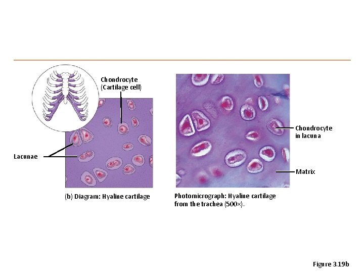 Chondrocyte (Cartilage cell) Chondrocyte in lacuna Lacunae Matrix (b) Diagram: Hyaline cartilage Photomicrograph: Hyaline