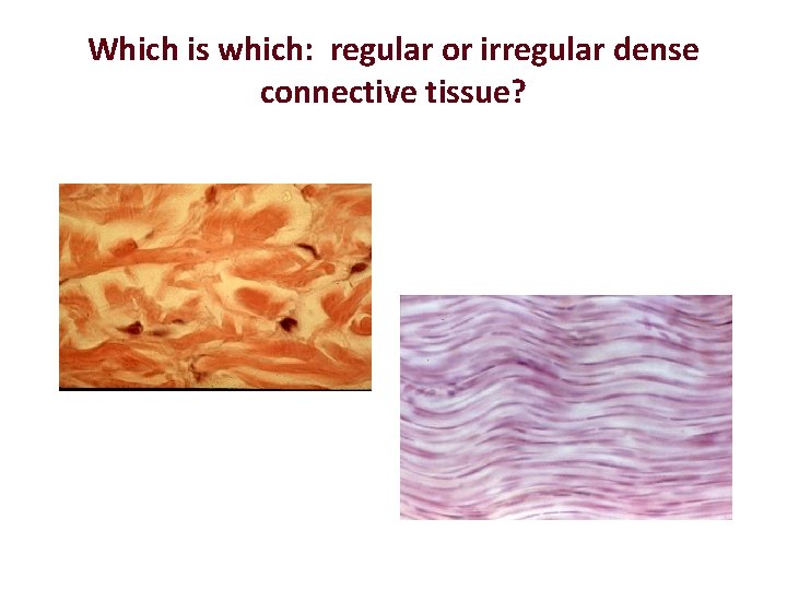 Which is which: regular or irregular dense connective tissue? 