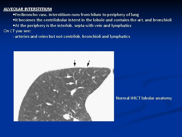 ALVEOLAR INTERSTITIUM • Peribroncho vasc. interstitium runs from hilum to periphery of lung •