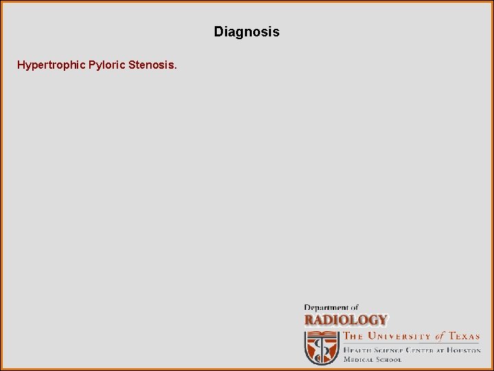 Diagnosis Hypertrophic Pyloric Stenosis. 