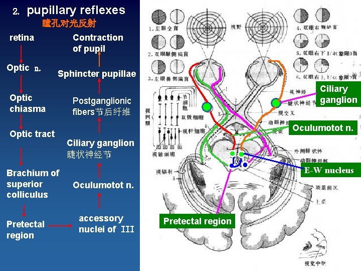 2. pupillary reflexes 瞳孔对光反射 retina Optic n. Contraction of pupil Sphincter pupillae Optic chiasma