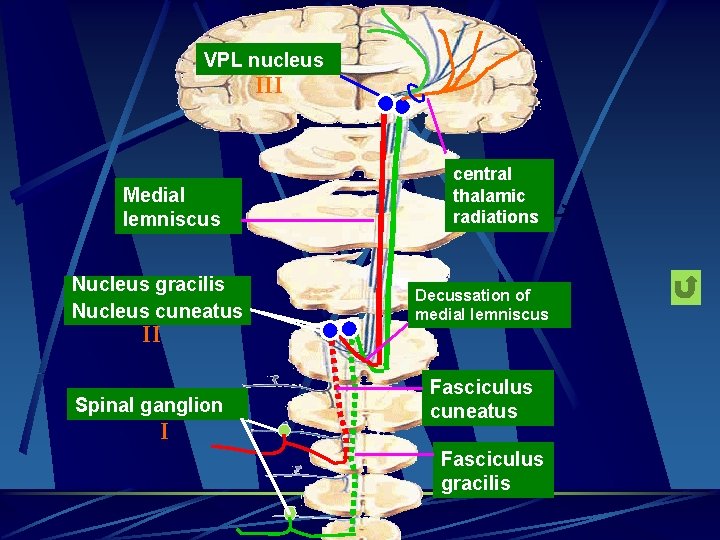 VPL nucleus III Medial lemniscus Nucleus gracilis Nucleus cuneatus II Spinal ganglion I central