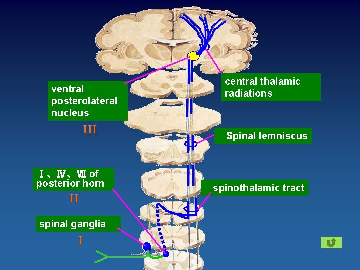 ventral posterolateral nucleus III Ⅰ、Ⅳ、Ⅶ of posterior horn II spinal ganglia I central thalamic