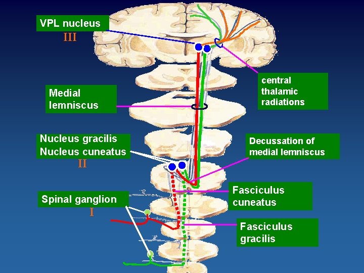VPL nucleus III Medial lemniscus Nucleus gracilis Nucleus cuneatus II Spinal ganglion I central