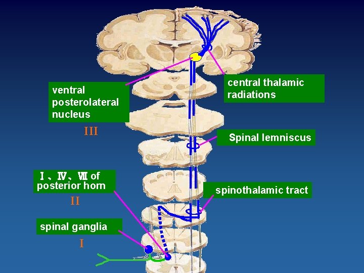 ventral posterolateral nucleus III Ⅰ、Ⅳ、Ⅶ of posterior horn II spinal ganglia I central thalamic