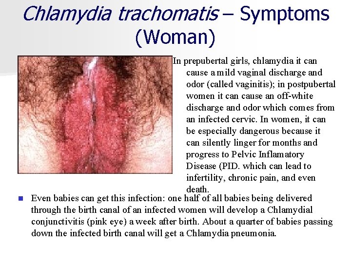 Chlamydia trachomatis – Symptoms (Woman) In prepubertal girls, chlamydia it can cause a mild