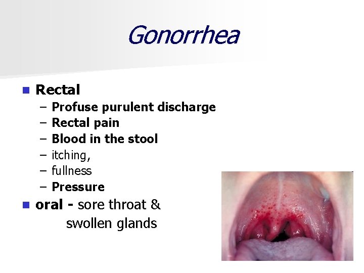 Gonorrhea n Rectal – – – Profuse purulent discharge Rectal pain Blood in the