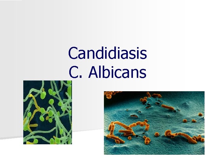 Candidiasis C. Albicans 