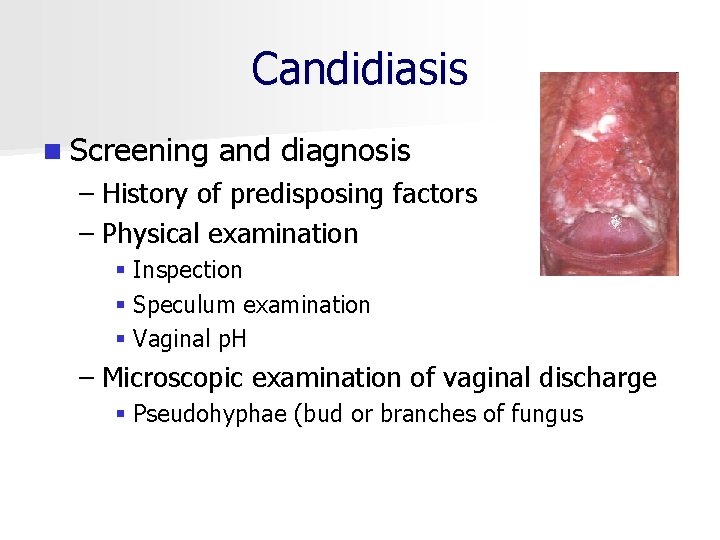 Candidiasis n Screening and diagnosis – History of predisposing factors – Physical examination §