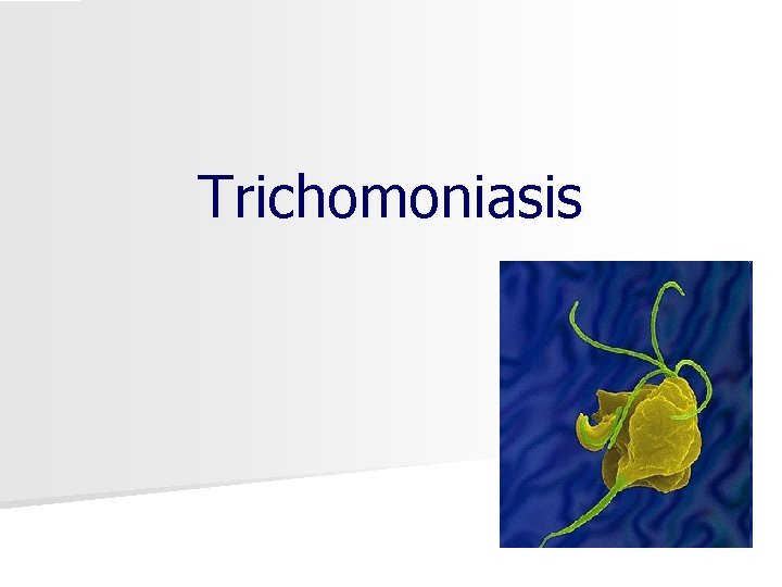 Trichomoniasis 