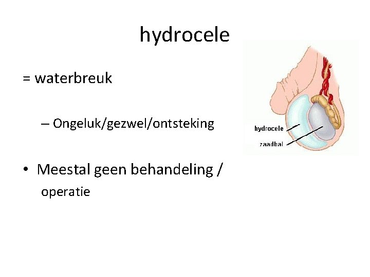  hydrocele = waterbreuk – Ongeluk/gezwel/ontsteking • Meestal geen behandeling / operatie 