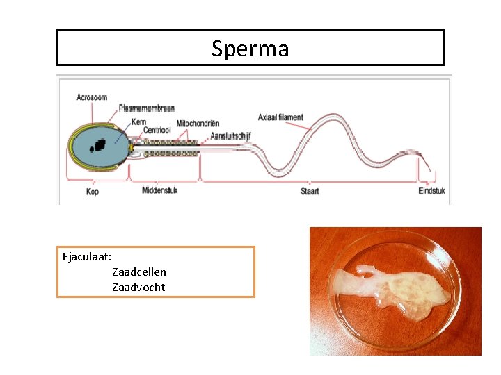 Sperma Ejaculaat: Zaadcellen Zaadvocht 