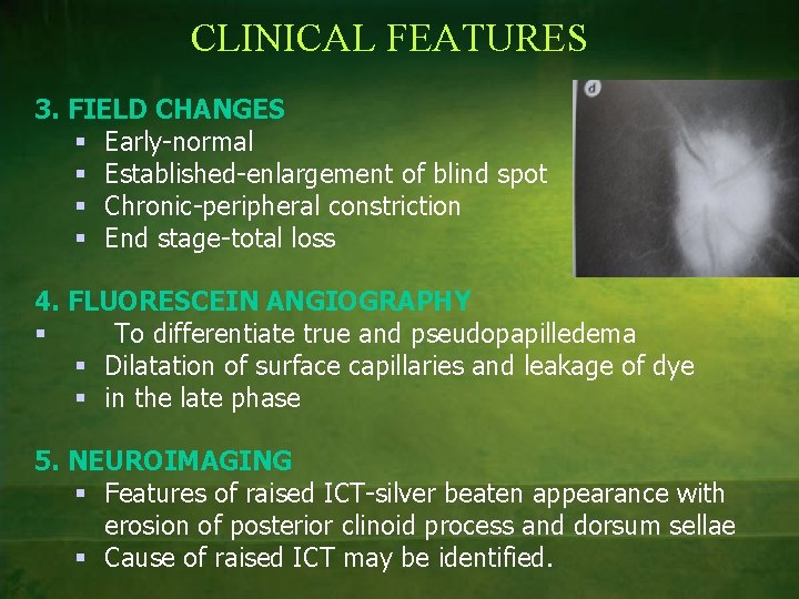 CLINICAL FEATURES 3. FIELD CHANGES § Early-normal § Established-enlargement of blind spot § Chronic-peripheral