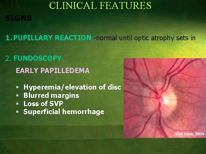 CLINICAL FEATURES SIGNS 1. PUPILLARY REACTION -normal until optic atrophy sets in 2. FUNDOSCOPY
