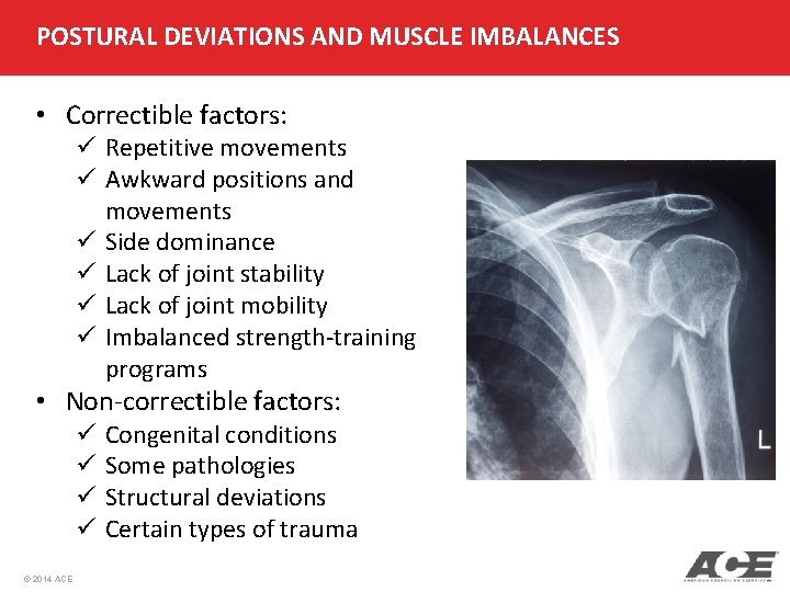 POSTURAL DEVIATIONS AND MUSCLE IMBALANCES • Correctible factors: ü Repetitive movements ü Awkward positions