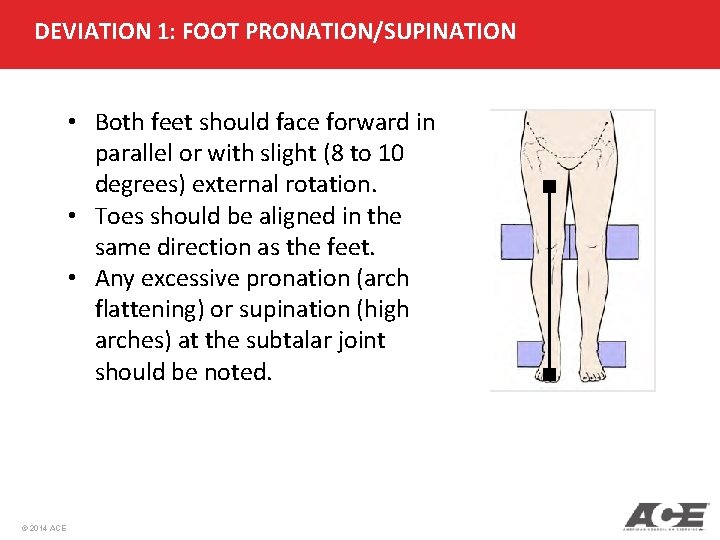 DEVIATION 1: FOOT PRONATION/SUPINATION • Both feet should face forward in parallel or with