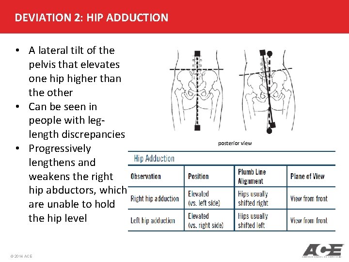 DEVIATION 2: HIP ADDUCTION • A lateral tilt of the pelvis that elevates one
