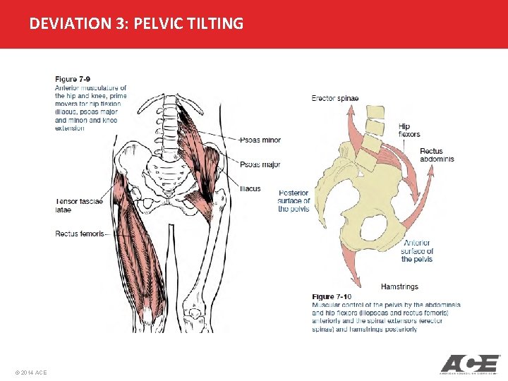 DEVIATION 3: PELVIC TILTING © 2014 ACE 