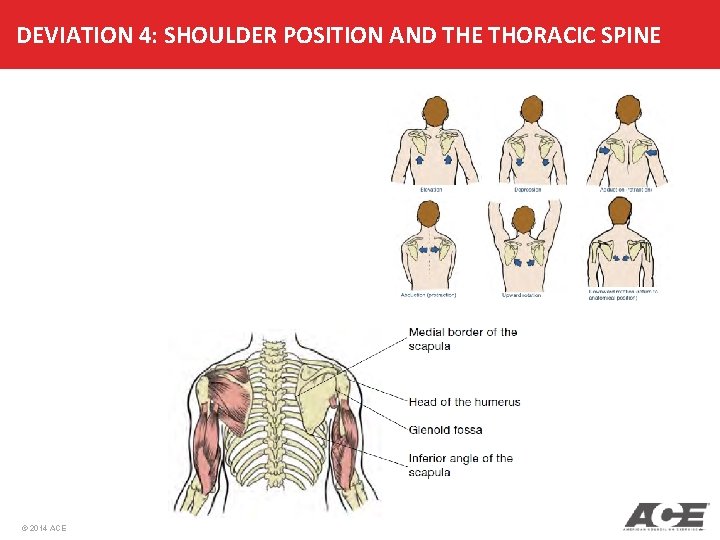 DEVIATION 4: SHOULDER POSITION AND THE THORACIC SPINE © 2014 ACE 