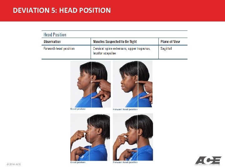 DEVIATION 5: HEAD POSITION © 2014 ACE 